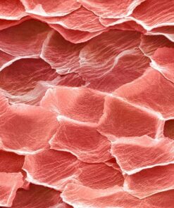 Anti-inflammatory